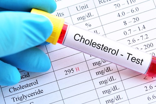 Cholesterol toàn phần là gì? Những điều bạn cần biết để ngăn chặn mối nguy cho sức khỏe!